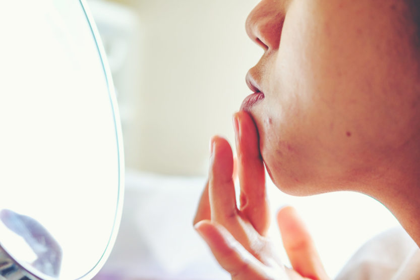 Halley Medical Aesthetics, lasers, laser treatments, pigmentation, Wrinkles, dark spots, acne, scars,, fraxel, long-pulsed, picosure, CO2,Q-switched