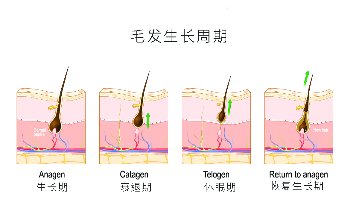 新加坡激光脱毛毛发生长周期巴西式脱毛