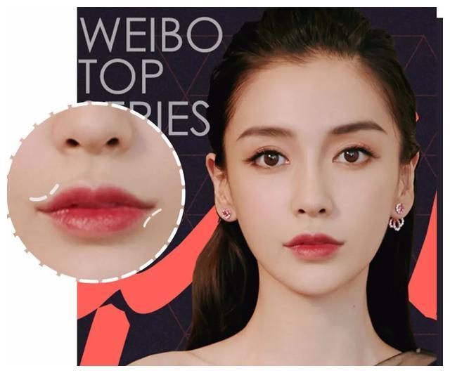 不同唇型 微笑唇 丰唇 填充剂 新加坡 