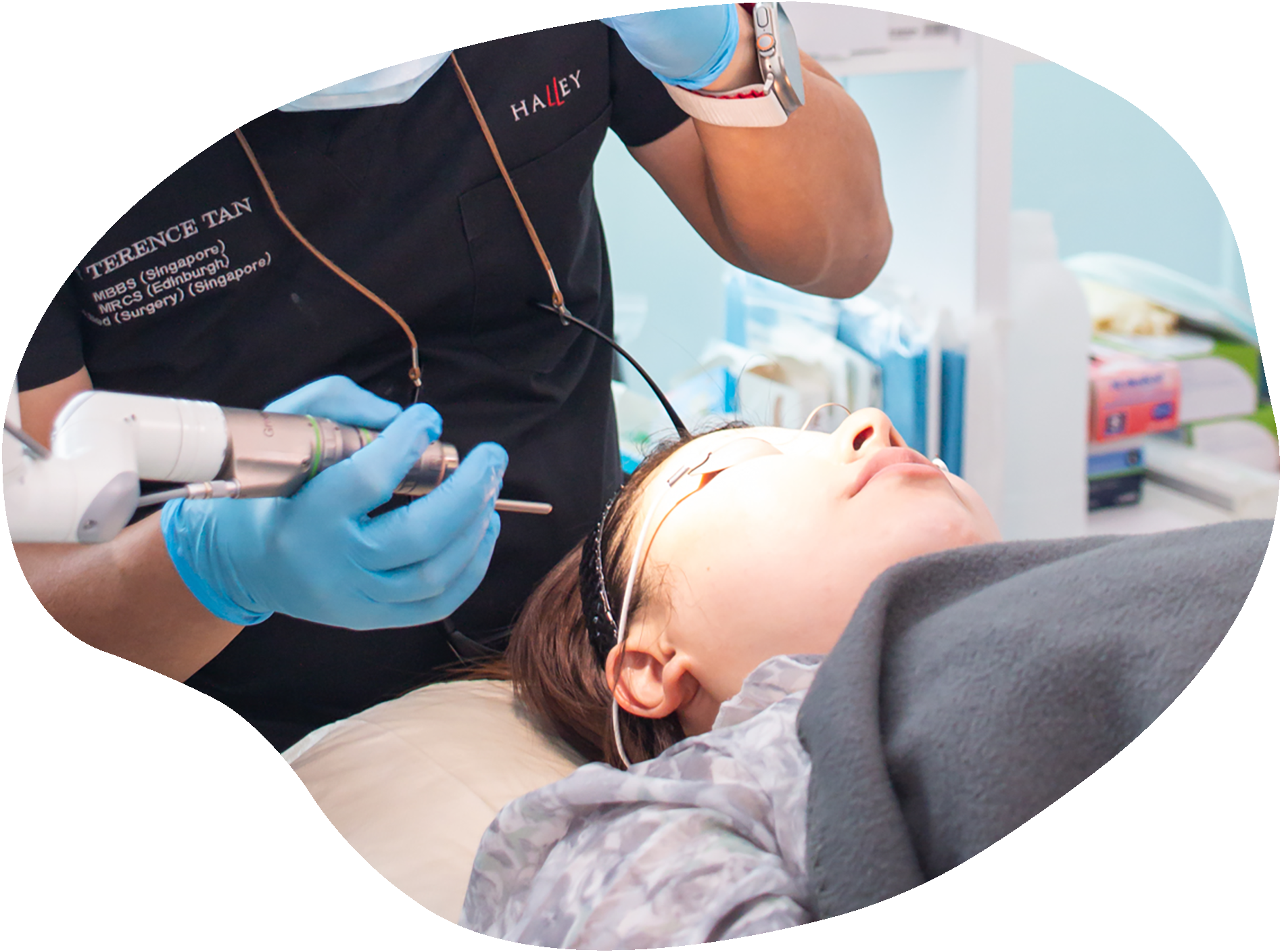 ピコシュアプロレーザー シンガポール