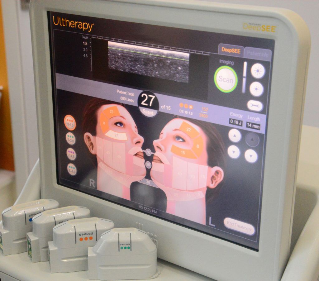 Ultherapy 800 Lines How many lines am I getting