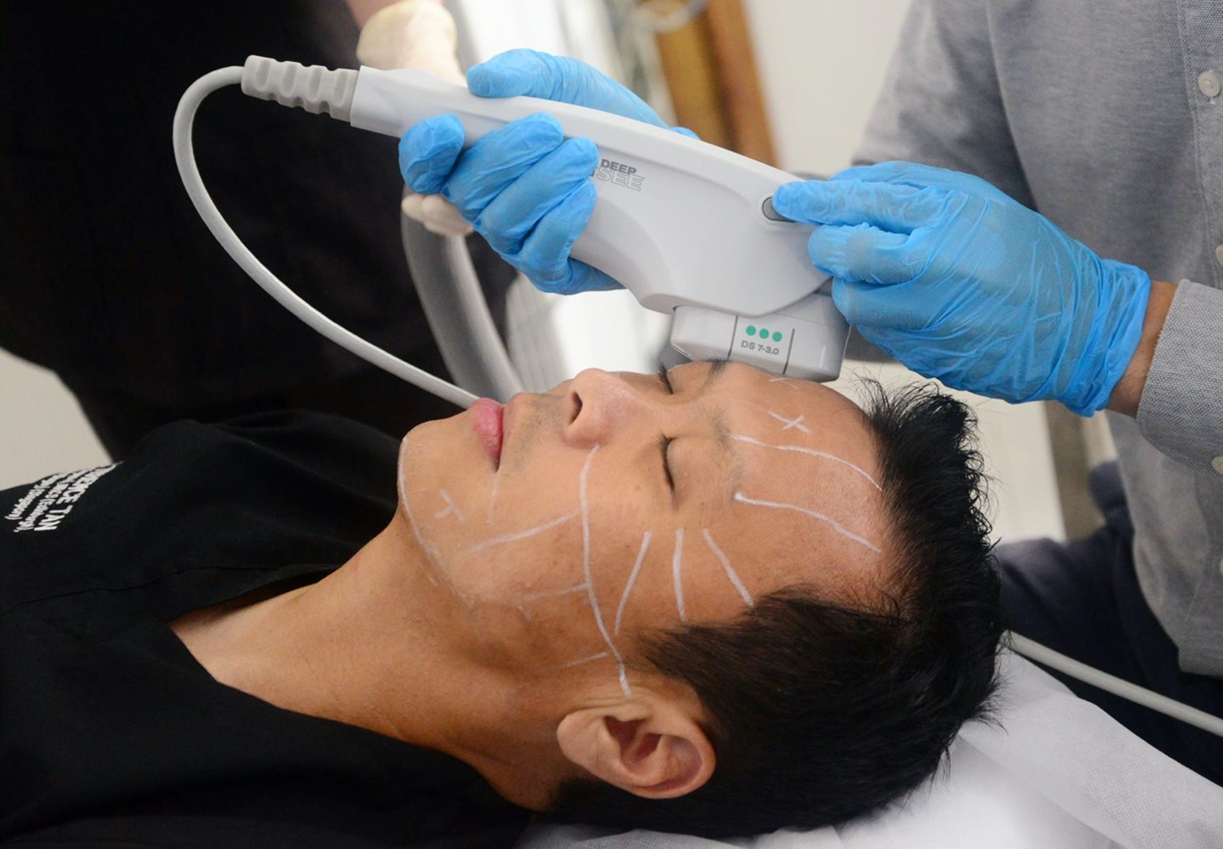 Halley Medical Aesthetics Singapore | Lift and Firm Your Skin with Ultherapy: The Non-Surgical Facelift