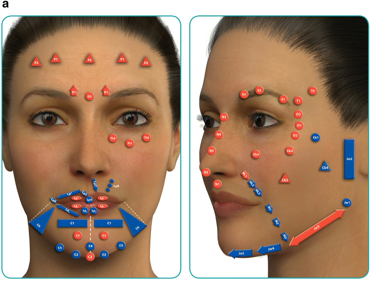 MD Codes Mapping Singapore Dermal Fillerfs