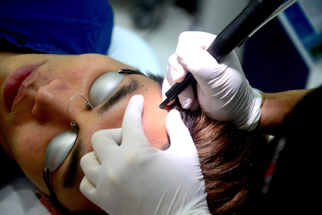 Doctor is performing Fractional CO2 Laser Treatment