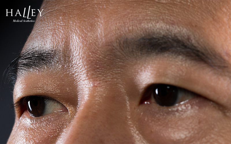 Close-up of person's eye and eyebrow area showing natural skin texture and fine lines under soft lighting.