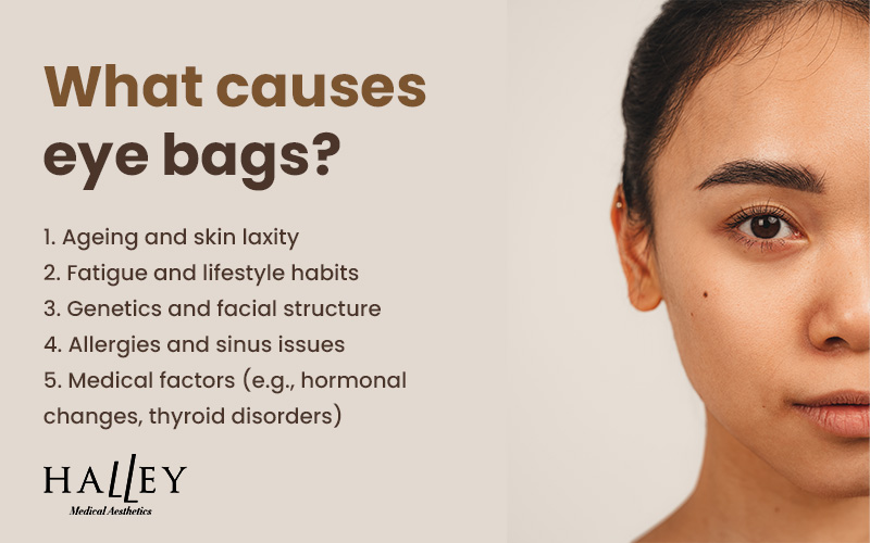 Infographic on five causes of eye bags