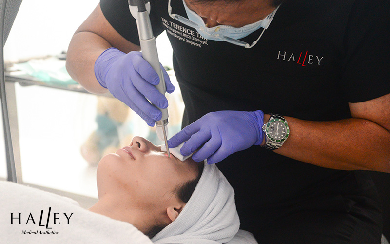 Practitioner in purple gloves using handheld device near patient’s eye during facial treatment at clinic.