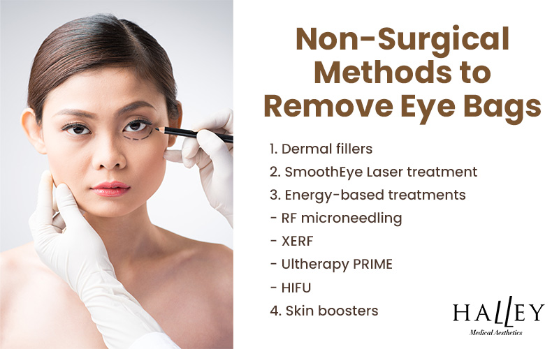 Woman receiving under-eye consultation with black pencil marking treatment area beside list of non-surgical options.