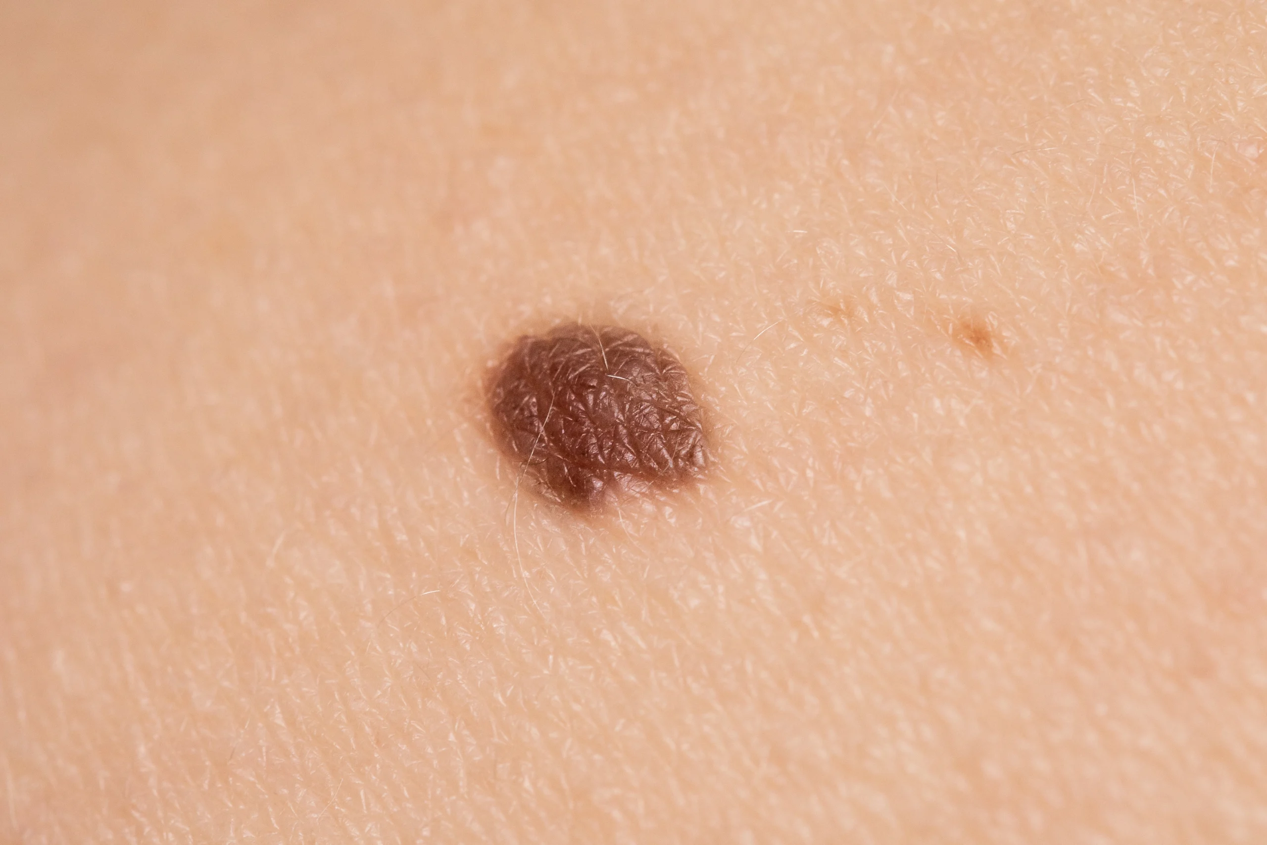 Moles