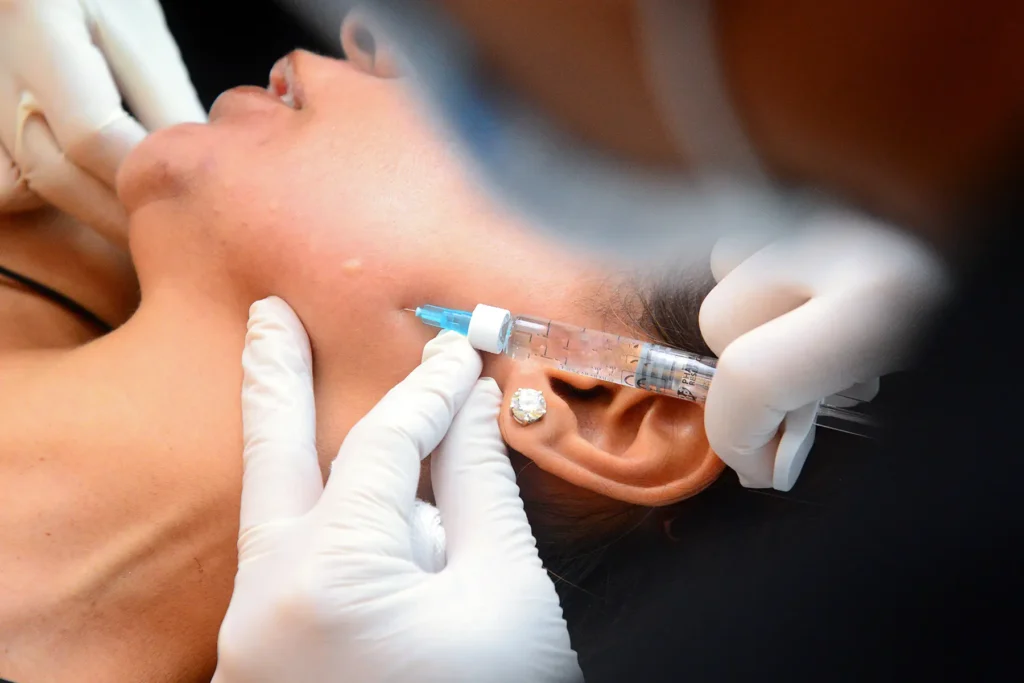 Rejuran Healer Treatment 02