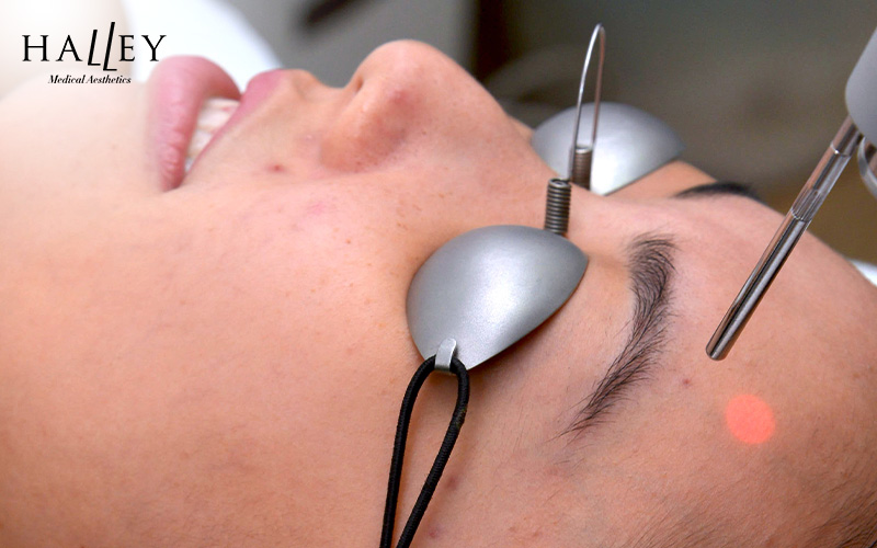 Doctor performing laser skin treatment
