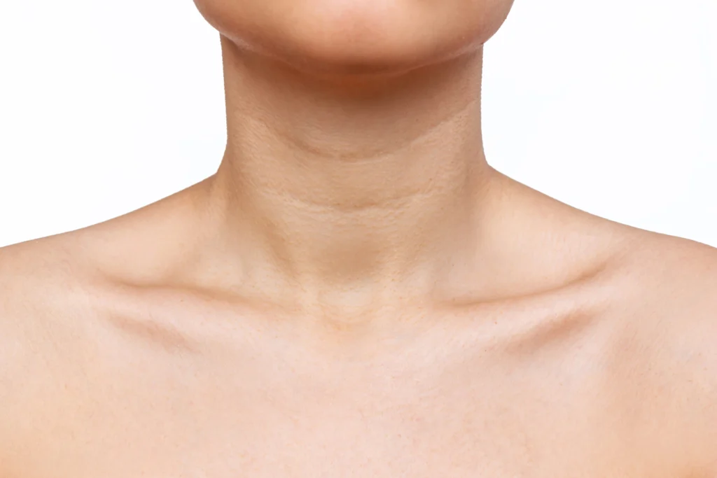 Neck lines (“Tech neck”)