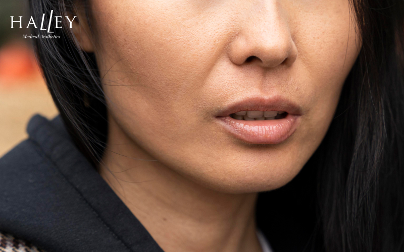 Close-up of skin texture and sagging around the jawline.