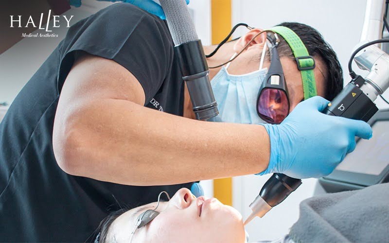 Professional performing laser treatment for melasma at Halley Medical Aesthetics.