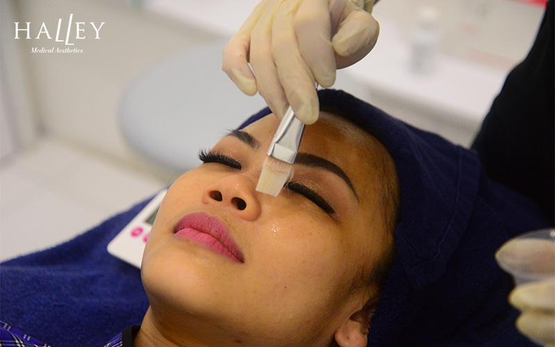 Therapist applying topical skin treatment for pigment and melasma correction.