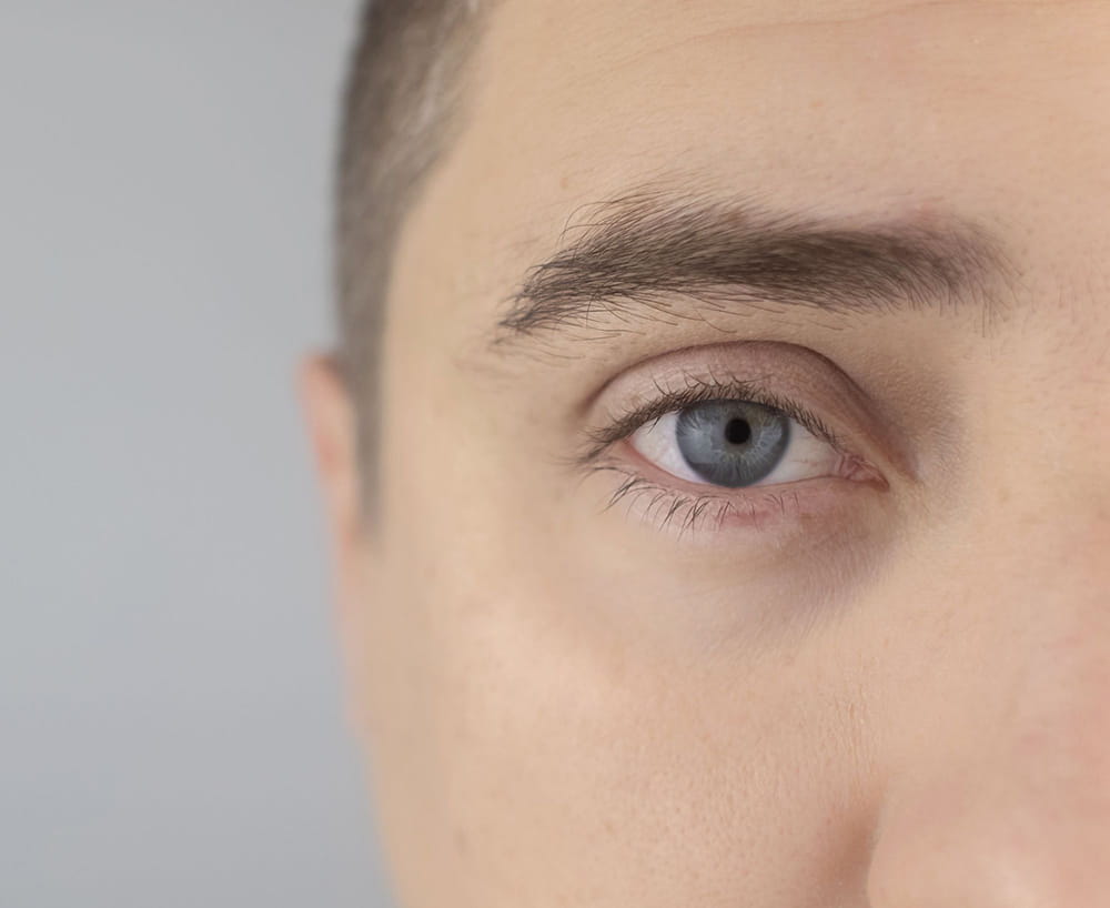 Who is suitable Under Eye Filler Tear Trough Filler