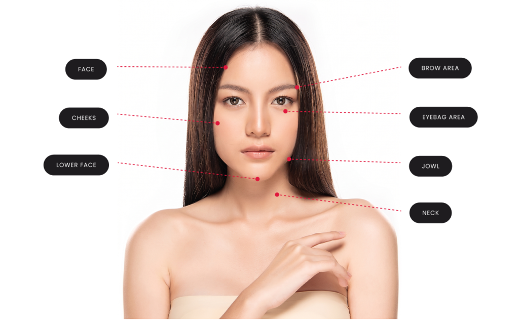HIFU skin tightening treatment areas