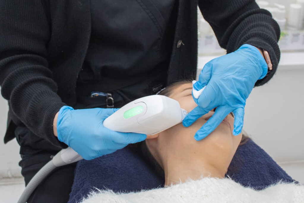 HIFU skin tightening treatment by Singapore clinic