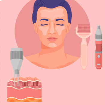 Traditional microneedling graphic